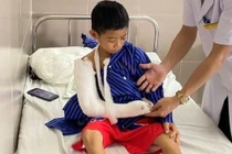 Nghỉ hè 1 tháng 50 trẻ nhập viện do tai nạn thương tích 