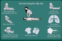 Kỹ năng sơ cứu đột quỵ tại nhà, cẩm nang sống còn cho người thân