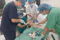 Bé gái 3 tuổi nguy kịch do hóc hạt hướng dương