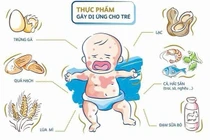 Hai trẻ dị ứng, sốc phản vệ nguy kịch do ăn trứng gà và tôm