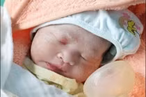 Cứu sống sản phụ thai 35 tuần tai biến sản khoa nguy hiểm 