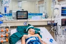 Đang chơi thì ngừng tim vì dị dạng động tĩnh mạch