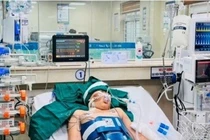 Đang chơi thì ngừng tim vì dị dạng động tĩnh mạch