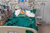 Chủ quan ho sốt, thiếu nữ 19 tuổi suy hô hấp nguy kịch