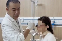 Người phụ nữ bị hoại tử mặt nặng sau một năm tiêm filler