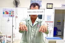 Tiêu sợi huyết giờ vàng cứu bệnh nhân đột quỵ trong lúc ăn cơm