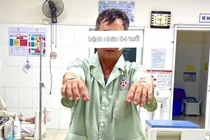 Tiêu sợi huyết giờ vàng cứu bệnh nhân đột quỵ trong lúc ăn cơm