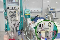 Biến chứng nguy hiểm gây viêm tụy cấp do mỡ máu ở phụ nữ mang thai