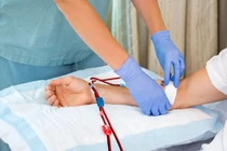 4 lần lọc máu liên tiếp cứu bệnh nhân viêm cầu thận tiến triển nhanh