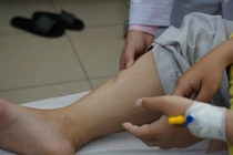 Bệnh thận âm thầm tấn công người trẻ do lối sống 'nhanh'