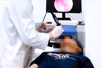 Bệnh nhi 14 tuổi mắc u xơ vòm mũi họng hiếm gặp