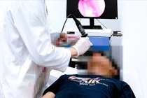 Bệnh nhi 14 tuổi mắc u xơ vòm mũi họng hiếm gặp