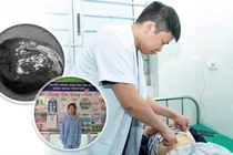 Phẫu thuật thành công ca u nang lách khổng lồ cho bệnh nhi ở Nghệ An