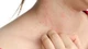 Mẹo giảm khó chịu do dị ứng thời tiết