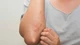 Giải mã lý do nhiễm khuẩn đường huyết có tỷ lệ tử vong cao