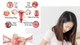 Bệnh phụ khoa phụ nữ trẻ thường gặp, cách phòng ngừa