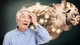 Cảnh giác với dấu hiệu sớm của Alzheimer