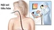Dấu hiệu cần nội soi tiêu hóa để phát hiện sớm bệnh lý