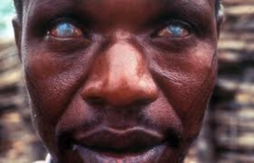 Những bệnh đáng sợ lây truyền do động vật