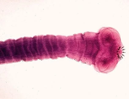 Rùng mình với những loài ký sinh trùng