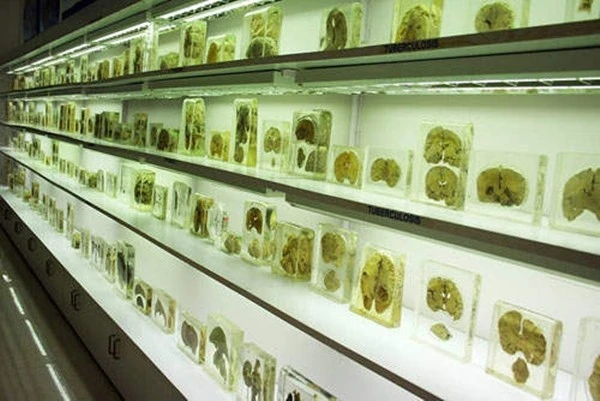 Rùng rợn bảo tàng não người ở Ấn Độ