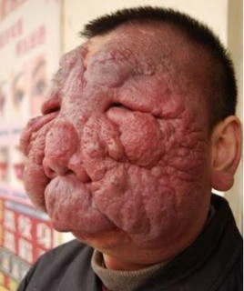 Hoảng hồn những “mặt nạ” trên cơ thể người 