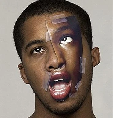 Trều môi, lác mắt vì ... ham hố làm đẹp