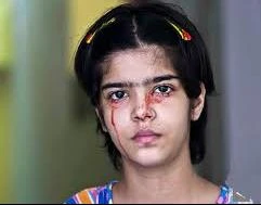 Hãi hùng những căn bệnh hiếm gặp trên thế giới (P3)