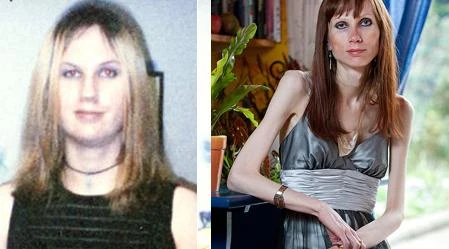 Bi kịch cô gái trong thân hình bà lão 70