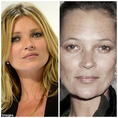 Những khuôn mặt xanh xao, rạn nứt vì hút thuốc lá