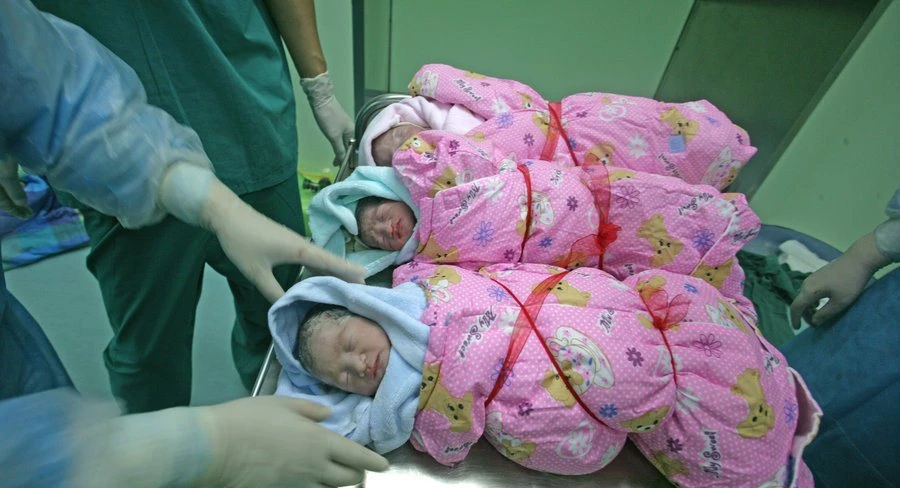 Cận cảnh một ca sinh 3 kỳ diệu