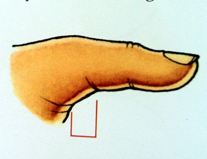 Đoán tài năng qua ngón tay cái 