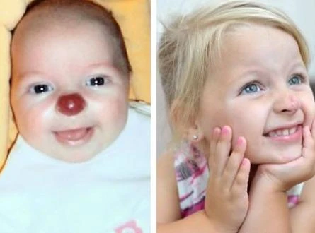 Những “vết bớt” kỳ quặc nhất quả đất