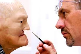 Chuỗi ảnh tái tạo khuôn mặt bị mất sau tai nạn