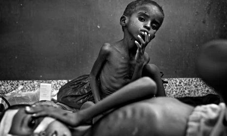 Động lòng hình ảnh trẻ đói ở Châu Phi