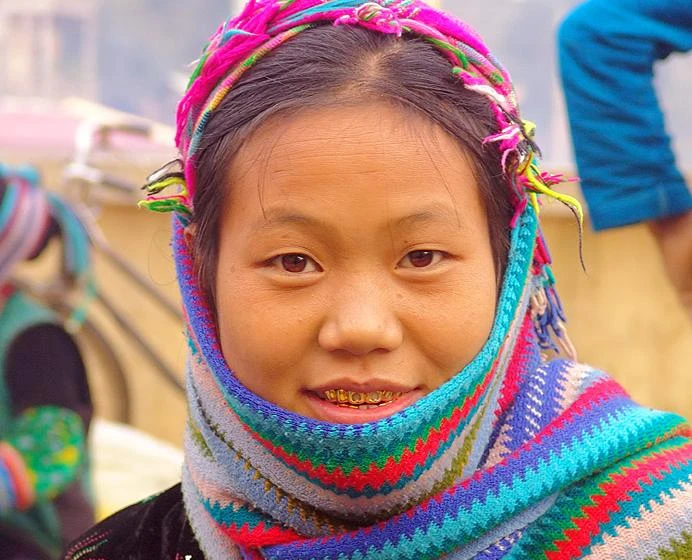 Sơn nữ răng vàng Việt Nam khiến Tây bị “hớp hồn“