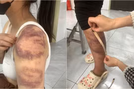 Công an Bắc Ninh tạm giữ người đàn ông đánh đập vợ con