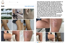 Người đàn ông tại Quảng Ngãi hành hung trẻ vị thành niên gây phẫn nộ