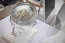 Quên Neuralink đi, chip não này làm được điều mà Elon Musk thèm muốn