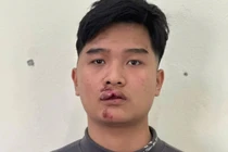 Khởi tố nam thanh niên lái xe máy đâm vào CSGT Hưng Yên