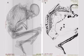 Khám phá bất ngờ về xác ướp thợ mỏ ở sa mạc Atacama