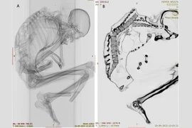 Khám phá bất ngờ về xác ướp thợ mỏ ở sa mạc Atacama