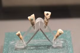 Tìm thấy trẻ em Maya 7 tuổi có ngọc răng xanh biếc kỳ lạ