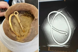 Kho báu vàng siêu hiếm xuất hiện bất ngờ giữa rừng sâu Ba Lan