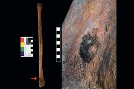 Hài cốt thiếu niên thời Đồ đá hé lộ sự thật kinh hoàng