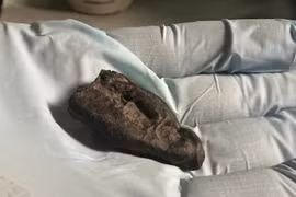 Bí ẩn thiếu nữ tuổi teen nhai 'kẹo cao su' hơn 10.000 năm trước