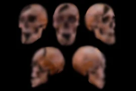 'Nội soi' hài cốt Công tước Hungary hé lộ cái chết tàn bạo