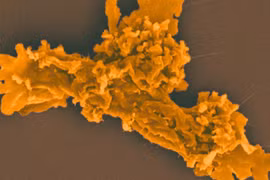 Bí ẩn sinh vật 'bất tử nhiệt', sức chịu nhiệt vượt ngưỡng sự sống