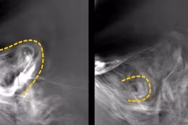 NASA tung ảnh Mặt trời gần nhất từng có, gây choáng ngợp