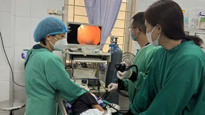 Gắp long đen kim loại nằm trong thực quản bé 7 tuổi